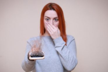 4 causes of hair loss