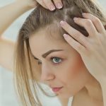 hormonal hair loss reversible