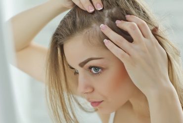 hormonal hair loss reversible